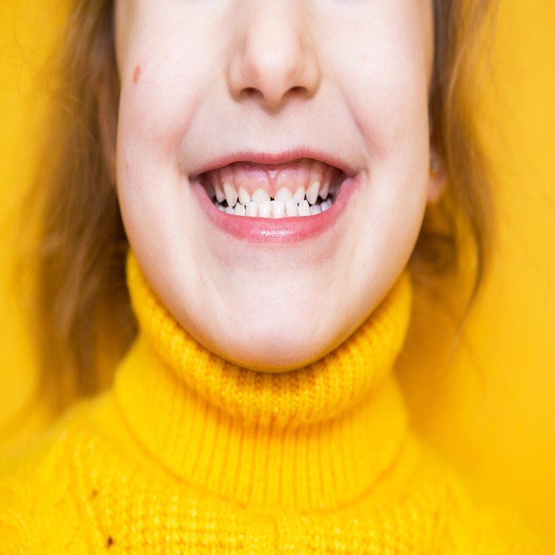 Periodontics in Edmond, OK