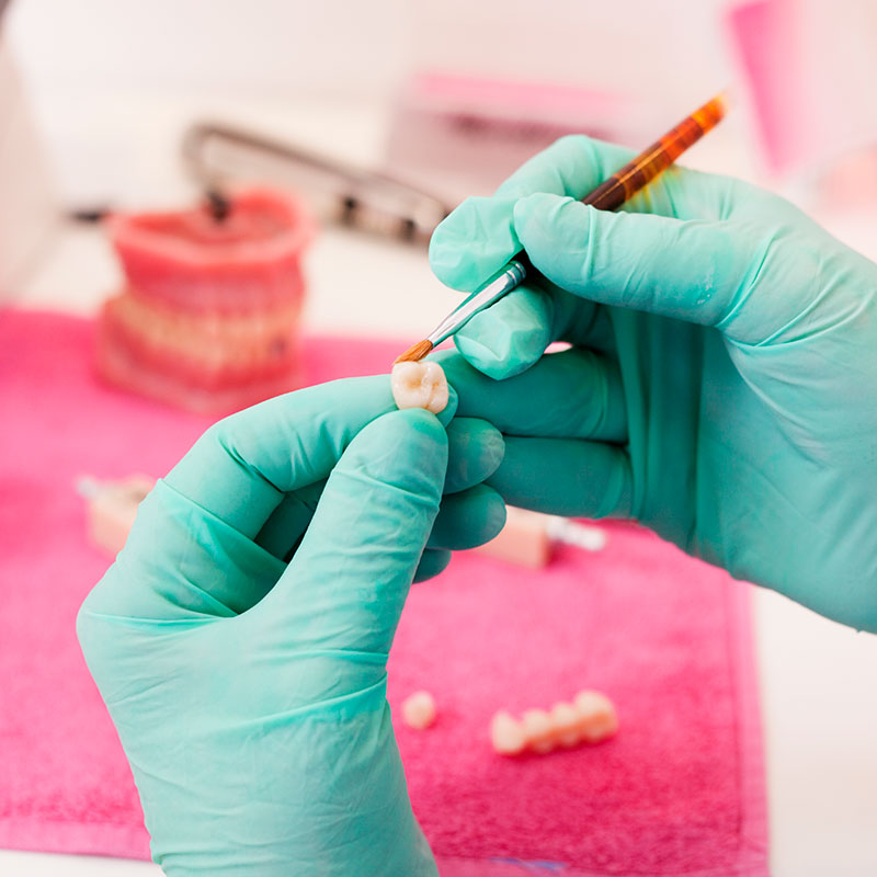 A dentist putting a dental crown