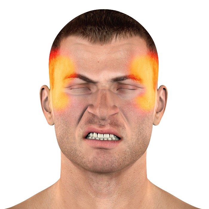 TMJ Disorder Treatment in Edmond, OK